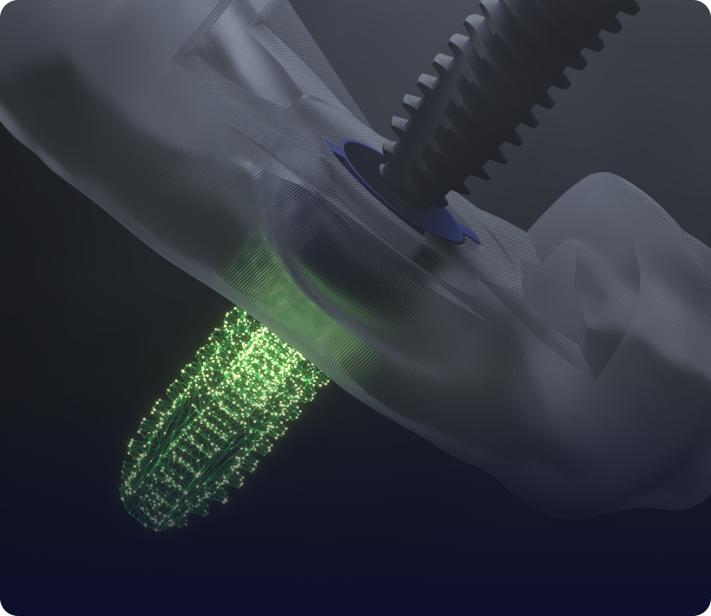 DIO Navi digital guided surgery image with green implant x-ray image.