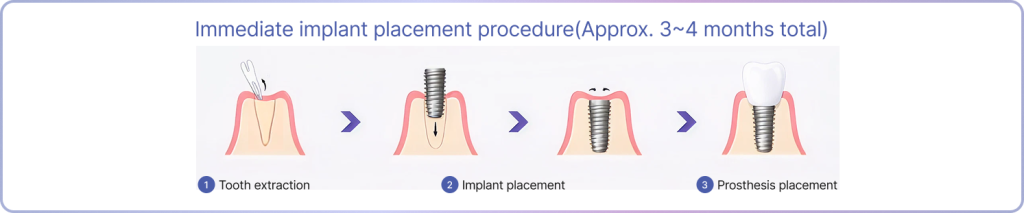 Dio Implant diagram.