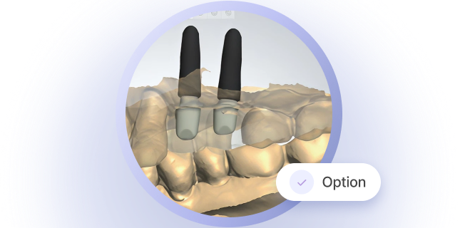 Render of a dental prosthetic.
