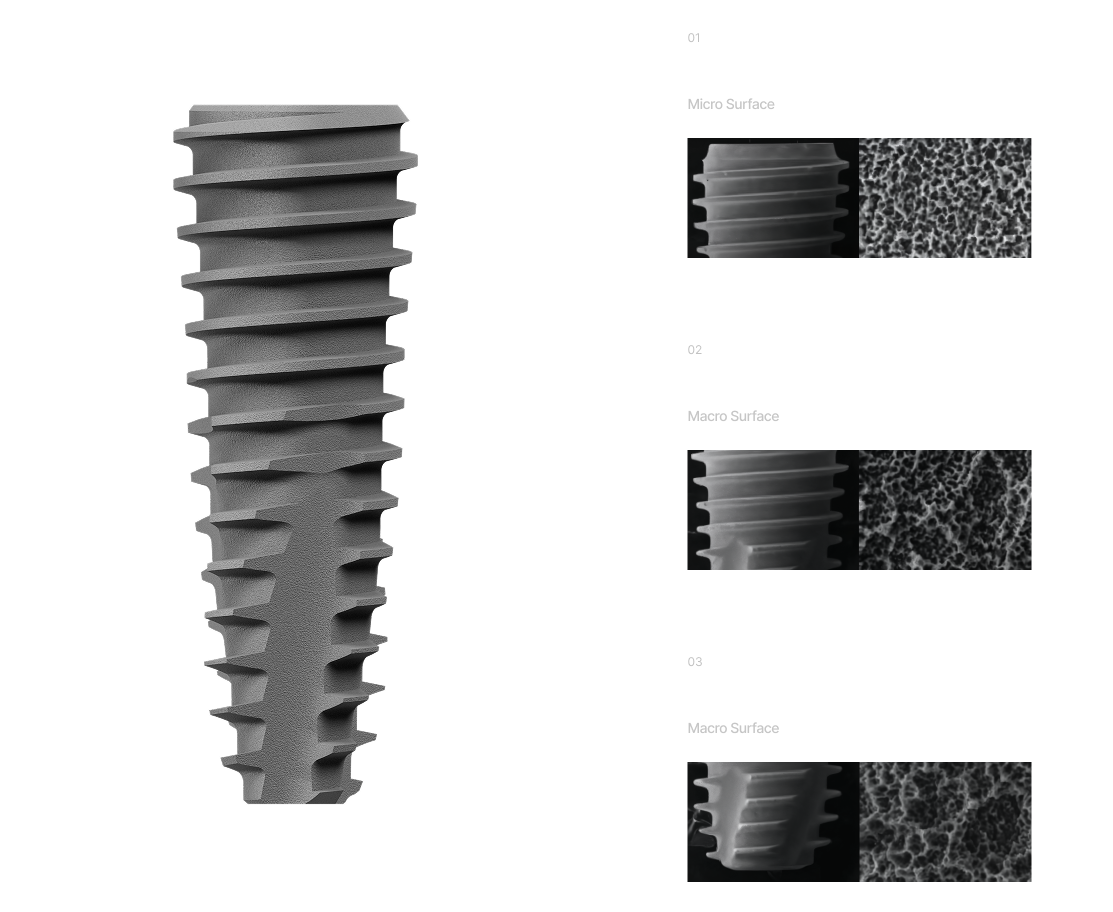 UFIII Implant with sections zoomed.