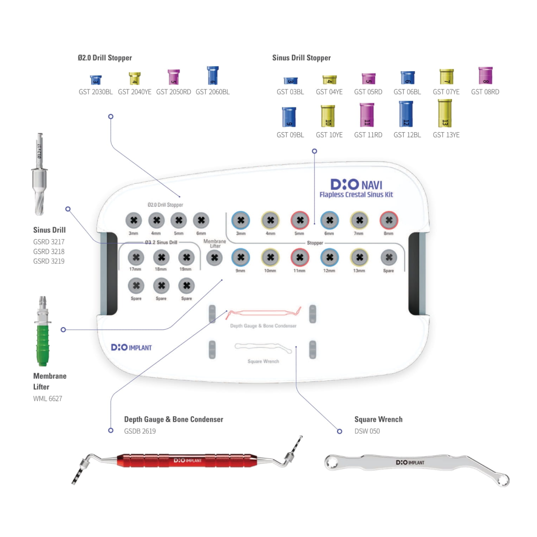 A dedicated kit for crestal sinus elevation using a flapless approach, featuring low-speed drilling with stoppers for controlled and safe membrane elevation. Compatible with placement of UFII/UFIII Regular fixtures (Ø3.8, Ø4.0, Ø4.5, Ø5.0).