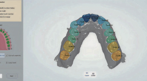 Scan of teeth.
