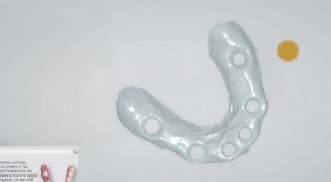 Clear render of teeth.