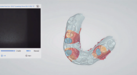 Lock data of teeth.