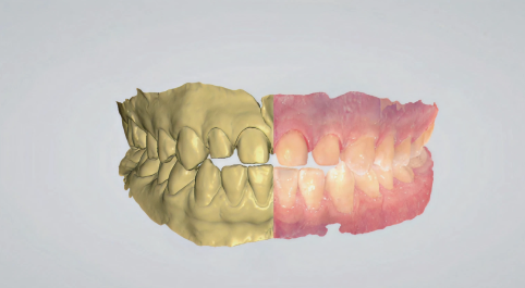 Render of teeth.
