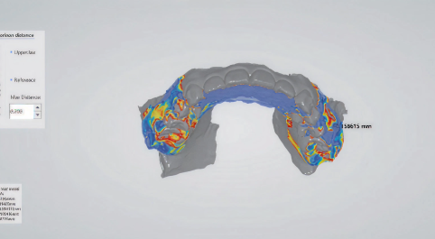 Scan of teeth.
